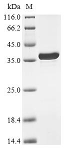 重组蛋白 Mycobacterium tuberculosi