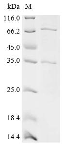 重组蛋白 Streptococcus pneumoniae