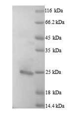 Human BCL2L11 Protein蛋白，orb358