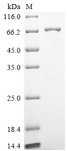重组蛋白 Human Ubiquitin carboxyl-