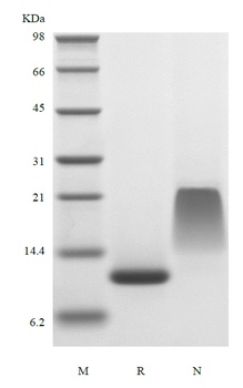 重组蛋白 Human Endocrine Gland-der