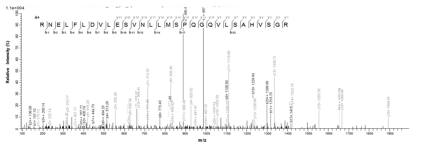 Human AP2M1 Protein蛋白，orb24629