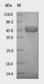 E. coli yegS Protein蛋白，orb3588