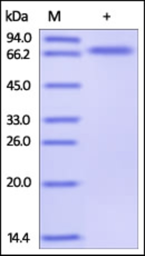 CD134 重组蛋白，orb1227934，biorbyt