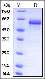 Dkk-3 重组蛋白,orb1227687,biorbyt