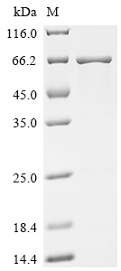 重组蛋白 Human Carboxylesterase 3 