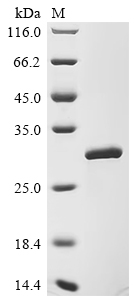 重组蛋白 Human NAD-dependent Prote