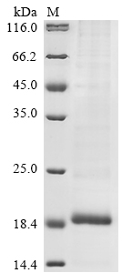 Avian infectious bronchitis vi