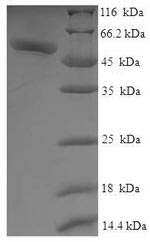 Human GALM Protein蛋白，orb244918