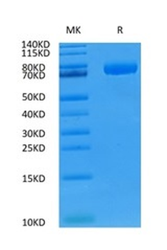 重组蛋白 human CD36 Protein蛋白, C-H