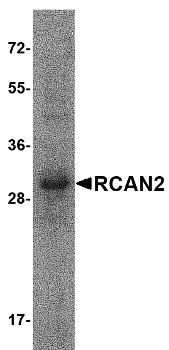 RCAN2 Isoform 2 重组蛋白,orb122821