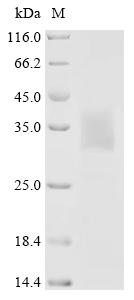 重组蛋白 Human Stimulator of inter