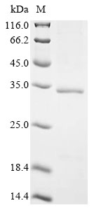 重组蛋白 African swine fever virus