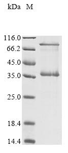 重组蛋白 Mycoplasma pneumoniae P30