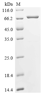 重组蛋白 Schistosoma japonicum Glu