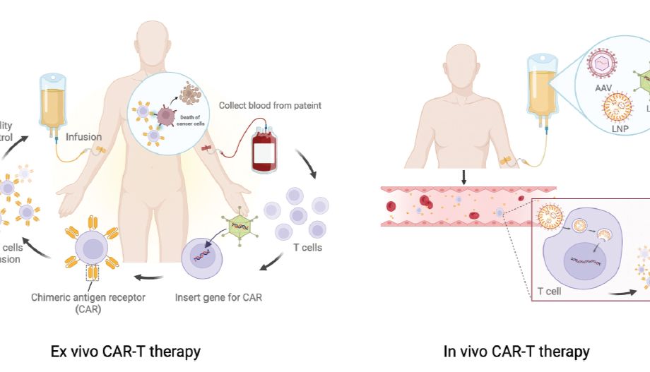 细胞治疗迈向真正药物化，In Vivo CAR-T全流程解析
