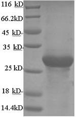 Bovine ADIPOQ Protein蛋白,orb244