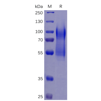 Human ICAM-1 Protein蛋白, mFc Ta