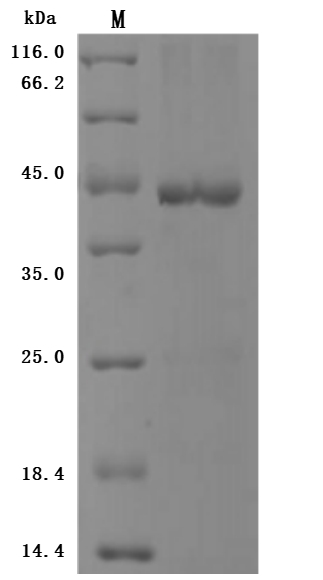 Human BRD4 Protein蛋白，orb147782