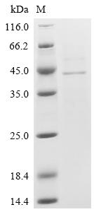 重组蛋白 Porcine reproductive and 