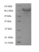 E. coli zwf Protein蛋白,orb24571