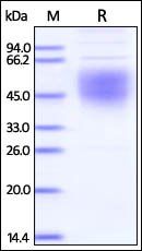 Ebolavirus Envelope Glycoprote