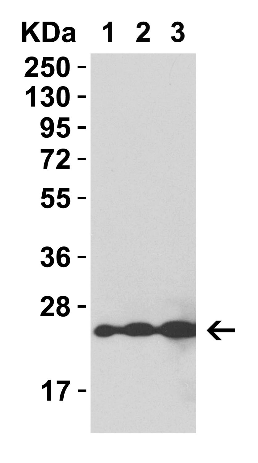 HIV-1 p24 重组蛋白，orb1671194，bior