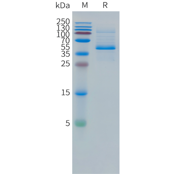 Cynomolgus FAP Protein蛋白, His 
