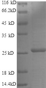 Human TIMP-4 Protein蛋白，orb2453
