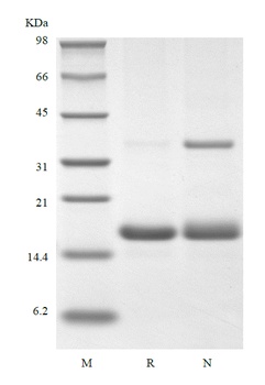 重组蛋白 Human Interleukin-16, 130
