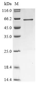 重组蛋白 Human Protein蛋白 GOLM2 (GO