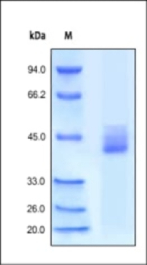 CXCR4 重组蛋白,orb1228093,biorbyt