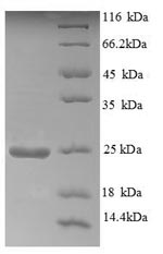 Human AOX1 AO Protein蛋白，orb244