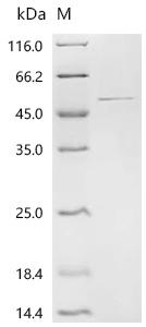 重组蛋白 Human Glutamine synthetas