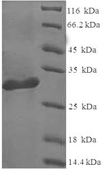 Human LGALS1 Protein蛋白，orb2443