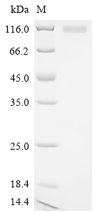 重组蛋白 Pig Glutamate carboxypept