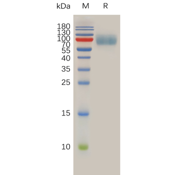Human CD117 Protein蛋白, His Tag