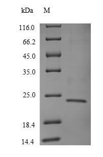 Human TRBC1 Protein蛋白，orb24602