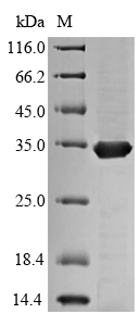 Bacterial fbpC Protein蛋白,orb35