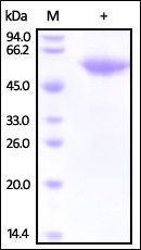 Human Fetuin B Protein蛋白, His 