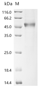 重组蛋白 Human Secreted and transm