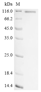 重组蛋白 Human Serine/threonine-pr