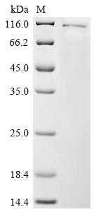 重组蛋白 Human DNA topoisomerase 1