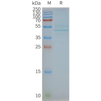 Human CCR3 full length Protein