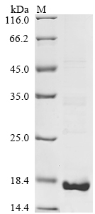 重组蛋白 Mouse Isoleucine--tRNA li
