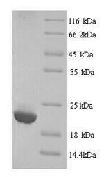 Human IGLL5 Protein蛋白，orb24684