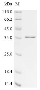 重组蛋白 BK polyomavirus Large T a