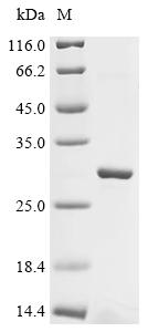 重组蛋白 Mouse Sorting nexin-32 (S