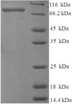 Rat Mmp2 Protein蛋白，orb244378，b