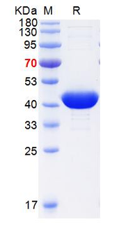 重组蛋白 human Creatine Kinase MM 